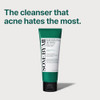 Some By Mi Bye Bye Blackhead 30 Days Miracle Green Tea Tox Bubble Cleanser & Miracle Acne Clear Foam