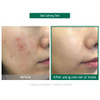 Some By Mi Hyaluron Moisturizing Glow Luminous Ampoule Beauty Mask 1 Sheet Mask 0.88 Oz (25 G)