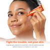 Aprilskin Peel & Clear Duo For Troubled Skin: Calendula Flower-Infused Facial Peel Off Mask And Carrotene Ipmp Clearing Solution