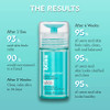 Bliss Clear Genius Clarifying Kit: Clear Genius Face Wash Toner + Serum Acne Spot Treatment Acne Body Spray And Overnight Liquid Peel