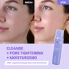 Dermalogy By Neogenlab Berrypore Pore Cleansing Mousse Deep Pore Cleanser With Aha/Bha Removes Excess Oil & Impurities K-Beauty Face Wash 5.07 Fl Oz (150 Ml)