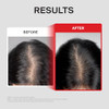 Dr.Forhair Folligen Thickening Scalp Serum 1.7 Oz Biotin Density Serum For Thicker Fuller-Looking Hair Peptide Scalp Treatment Korean Haircare