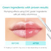 Dr.Melaxin Bp Spicule Plumping Lip Shot Maxi Microneedle Lip Plumper For Fuller Lips & Smooth Texture Hyaluronic Acid & Peptides For Volume & Fine Line Care Korean Lip Treatment
