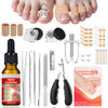 Elalrau Ingrown Toenail Removal Kit Professional Ingrown Toenail Treatment Ingrown Toenail Tools Kit With Ingrown Toenail Corrector Drops Toenail Clipper Corrector Patch Stainless Steel Pedicure Tool Set