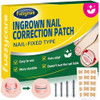 Fuzzycare Large Size-Titanium Alloy Ingrown Toenail Treatment & Removal Kit For Quick Relief Ingrown Toenail Removal Kit Professional Ingrown Toenail Corrector Ingrown Toenail Tools For Quick Relief 10 Pcs
