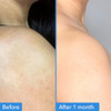 Good Molecules Discoloration Correcting Body Treatment - Anti-Pigment Cream With Niacinamide Tranexamic Acid - Target Dark Spots And Moisturize - Skincare For Body