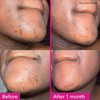 Good Molecules Brightening & Dark Spots Bar - Soap Face And Body Bar - Tranexamic Kojic Acids And Niacinamide To Target Dark Spots - Skin Care