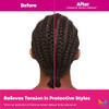 Matrix Instacure Tension Reliever Leave-In Scalp Serum - Moisturizes Dry And Irritated Scalp Cools Tension In Braids Protective & Tight Hairstyles 6.8 Fl Oz