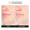 Paula's Choice Skin Perfecting 1% Bha Exfoliating Gel Toner For Sensitive Skin Gentle Facial Smoother With Salicylic Acid And Allantoin For Redness Clogged & Enlarged Pores Fragrance-