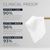 Roc Retinol Correxion Line Smoothing 2-Step Peel Pads With Clinical Retinol & 5-Acid Blend Resurfacing Treatment For Fine Lines Dullness And Pores 20 Treatments