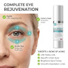 Skin Perfection Eye Bright Anti-Aging Eye Cream 25% Argireline 15% Matrixyl 8% Pepha Tight Hyaluronic Acid Crow's Feet Lift Lids Under-Eye Dark Circles Puffiness Antioxidants 0.5 Oz