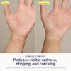 Skinfix Hand Relief Cream - 3 Fl Oz - Reduces Visible Redness Stinging & Cracking For Dry Sensitive Skin - Accepted By The National Eczema Association - Fragrance - Vegan Cruelty