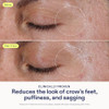 Skinfix Triple Lipid Eye Treatment - 0.5 Fl Oz - Eye Cream - Visibly Tightens Depuffs & Smooths Undereyes - Non-Comedogenic - Fragrance - Vegan Cruelty