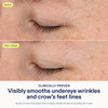 Skinfix Triple Lipid-Boost 360 Eye - 0.5 Fl Oz - Visibly Smooths Undereye Wrinkles & Crow S Feet Lines With Hyaluronic Acid - Non-Comedogenic - Vegan Cruelty - Founded In Canada