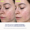 Skinfix Skin Barrier Restoring Gel Cream - 1.7 Oz - Non-Greasy Moisturizer For Normal To Combination Skin - Hydrates Plumps & Smooths - Non-Comedogenic Fragrance Vegan Cruelty