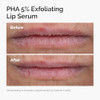The Ordinary Pha 5% Exfoliating Lip Serum Hydrating Overnight Lip Exfoliator Treatment 0.5 Fl Oz