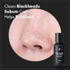 Tosowoong Zero Black Cleaner Blackhead Remover With Salicylic Acid Witch Hazel And Charcoal Exfoliating Face Wash Sebum Softener And Chemical Peel For Face Korean Skin Care 50Ml 1.69 Fl. Oz