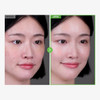 Tosowoong Kakadu Plum Blemish Cream Dark Spot Remover For Face Cream Kakadu Plum 600000Ppm Niacinamide Adenosine Betaine Dark Spot Corrector Vitamin C Korean Skin Care 50G 1.76 Oz