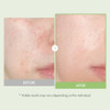 Tosowoong Real Relief Noni Ampoule 701518Ppm Noni Leaf Juice Korean Skincare Calming Serum Dark Spots & Fine Lines Hydration Moisturizing Anti Aging Glass Skin Glow 33Ml / 1.11 Fl. Oz