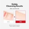 Vt Cosmetics Azelaic Acid Cleansing Oil For Acne-Prone & Sensitive Skin Lightweight Watery Texture Makeup Remover Pore Cleansing Oil Removes Spf & Sebum Blackhead Care (200 Ml / 6.76 Fl Oz)