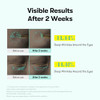 Vt Cosmetics Pdrn Reedle Shot Firming Eye Cream 0.51 Fl Oz / 15Ml  Ultra-Micro Vibration Eye Cream For Firming & Elasticity Targeted Wrinkle Care Pdrn Collagen Korean Skincare
