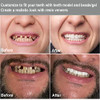 Brige Tooth Repair Kit For Fixing The Missing Chipped And Broken Tooth Gap Temporary Replacement Thermal Beads And Fake Teeth Brace Mold
