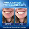 Pop On Veneers Teeth Whitening Strips For Sensitive Teeth And Gums - Peroxide Free And Enamel Safe With Coconut Oil For Gentle And Whiter Teeth - 7-Day Treatment White Strips With Non-Slip And Dry-Strip Technology