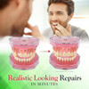 Smile Fix Smilefix Basic Dental Repair - For Missing Or Damaged Teeth - Fix Gaps Missing Teeth Spaces Broken Tooth Repairs - Fast & Easy - Confident Smiles - Bf Products - Durable Compound