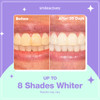 Smileactives Teeth Whitening Pen For White Smile Fast Tooth Whitener And Stain Remover With Precision Brush Tip Dental Quality Whitening Gel Travel Pen Easy To Use Ultra Mint Flavor 2 Pack