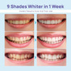 Whitebite Pro Teeth Whitening Pens & Whitening Kit Bundle