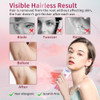 Bestechy Mini Epilator - Hair Remover For Women, Full Body Smooth Glide Epilator, With Led Light For Precision, Portable Electric Lady Shaver For Face, Armpits, Arms, Bikini, And Legs