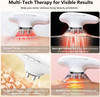 Cxgrise Body Sculpting Machine, 4 In 1 Cellulite Remover For Legs, Adjustable Cellulite Massage Tool, Home Use Cupping Therapy Tool For Belly, Waist, Arms, Legs And Face (Beige)