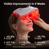 Aesthifae Red Light Therapy For Face And Neck, Red Light Therapy Mask Portable Led Face Mask Cordless, Eye-Protection For True Anti-Wrinkles Skincare At Home