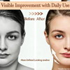 Fuoucsa Electric Double Chin Device Facial Massager,V-Shaped Face Machine With 8 Modes & 15 Intensity Levels,Intelligent V-Face Device For Daily Skincare,Double Chin Machine