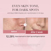 Medicube Pink Glow Home Care Duo: Pdrn Pink Peptide Toner And Collagen Jelly Cream (110Ml)