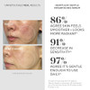 Murad Heartleaf Gentle Resurfacing Serum Low-Dose Glycolic Acid Aha And Heartleaf Comfortably Exfoliates Senstive Skin To Improve Radiance And Smooth Fine Lines & Wrinkles 1.0 Fl Oz