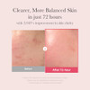 Medicube Ultimate Clear Glass Skin Serum Duo: Txa + Niacinamide 15% Glow Facial Serum And Pdrn Pink Peptide Serum For Uneven Skin Tone And Texture | Korean Skincare s For Women