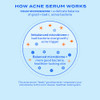 Murad Biome-Balancing Acne Treat Salicylic Mandelic And Glutamic Acid Serum For Clearing And Preventing Breakouts Decongesting Pores And Balancing Skin Microbiome 1.0 Fl Oz