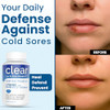Clear Probiotics Lysine Cold Sore Treatment For Lips With Pre Probiotics & Vit
