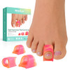 Welnove Hammertoe Corrector - Toe Splints - Soft Gel Toe Straighteners - Realign Bent Curled Crooked Claw Hammer Toes - Toe Corrector For Men And Women 3 Different Sizes (Patterned) 6 Pack