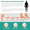 Welnove Hammertoe Corrector - Toe Splints - Soft Gel Toe Straighteners - Realign Bent Curled Crooked Claw Hammer Toes - Toe Corrector For Men And Women 3 Different Sizes (Patterned) 6 Pack