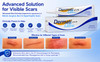 Bedront 1 Tube 15 Grams of Dеr-mаtiх Ultra  Advanced Scar Formula Advanced Silicone Gel for Cosmetic Improvement of Keloids Surgical Burn and Hypertrophic Scars