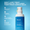 Murad BiomeBalancing Acne Treatment Salicylic Mandelic And Glutamic Acid Serum For Clearing 1.0 Fl Oz
