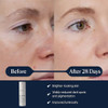 Elemis Dynamic Resurfacing SuperC Serum Daily AntiAging Antioxidant Serum Brightens Refines And 30 Ml