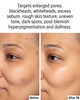 Allies Of Skin Azelaic and Kojic Clarifying Face Serum Clinically Proven For Acne and 1 Fl Oz