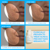 Innisfree Gentle Retinol Salicylic Acne Serum Korean Face Treatment With Niacinamide And