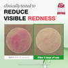 Physiogel Rosateca Redness Reducing Serum With Troxerutin Reduces Visible Redness and Support 30Ml
