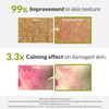 Zeroid Intensive Cream Face Moisturizer For Dry Sensitive Skin Skin Barrier Repair 2.7 Fl Oz