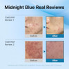Dearklairs Blue Comforting Duo CalmingandRich Moist Soothing Creams For Deep Moisture Korean
