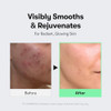 Vt Cosmetics Vt Cosmetics Bundle Reedle Shot 100 + 300 + 700